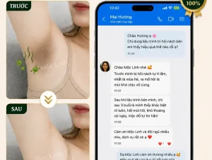 Trị hôi nách Hải Phòng