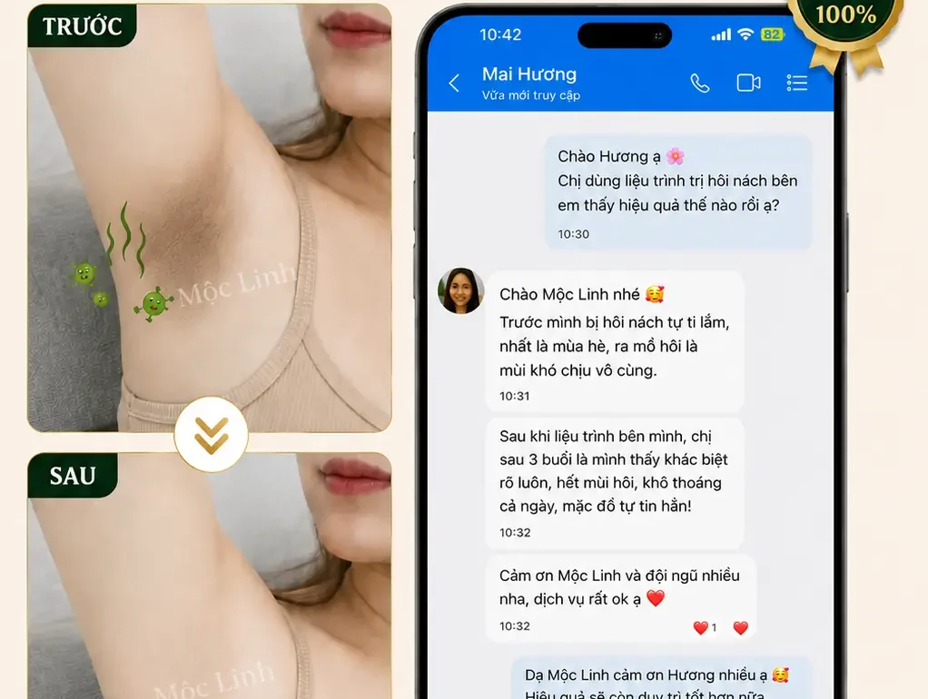 Trị hôi nách Hải Phòng