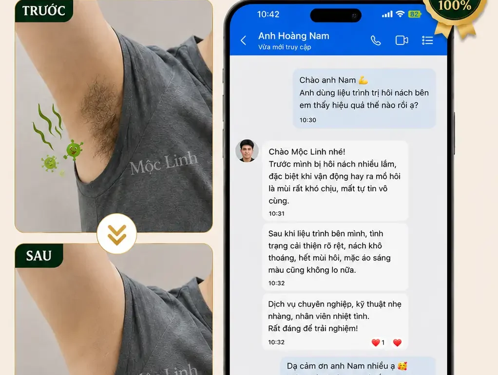 Trị hôi nách Hải Phòng