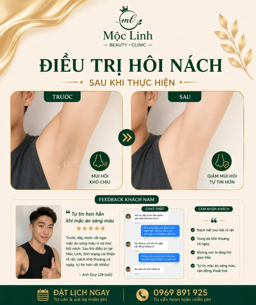 Trị hôi nách Hải Phòng