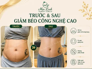 Giảm Béo An Toàn Hải Phòng