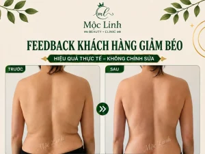 Giảm Béo An Toàn Hải Phòng