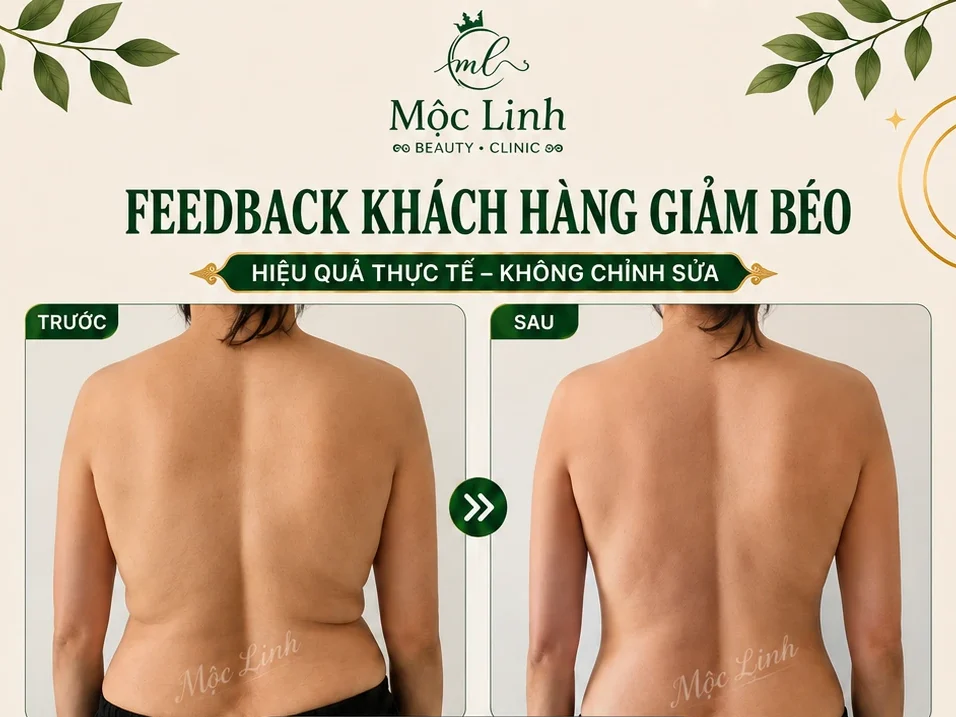 Giảm Béo An Toàn Hải Phòng