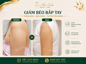 Giảm Béo An Toàn Hải Phòng