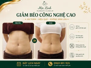 Giảm Béo An Toàn Hải Phòng