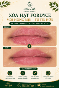 Xoá hạt Fordyce Hải Phòng