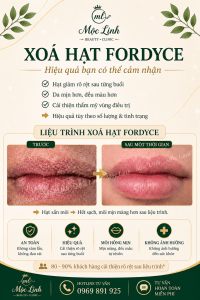 Xoá hạt Fordyce Hải Phòng