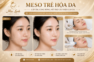 Tiêm Meso Hải Phòng