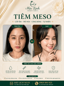 Tiêm Meso Hải Phòng