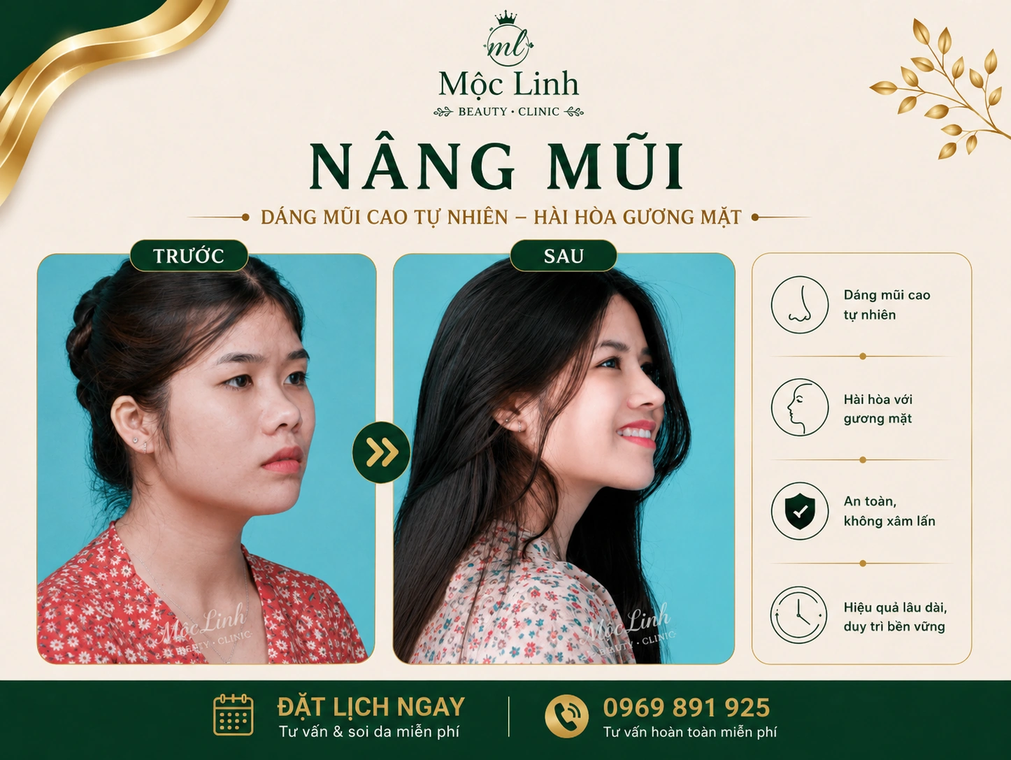 Bác sĩ tư vấn nâng mũi an toàn tại Thẩm Mỹ Mộc Linh Hải Phòng