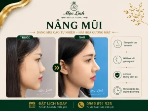 Nâng Mũi Uy Tín Tại Hải Phòng