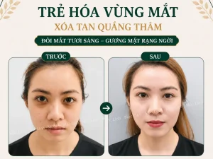 Chữa thâm mắt uy tín Hải Phòng