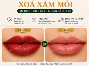 Xoá xăm mày – môi Hải Phòng