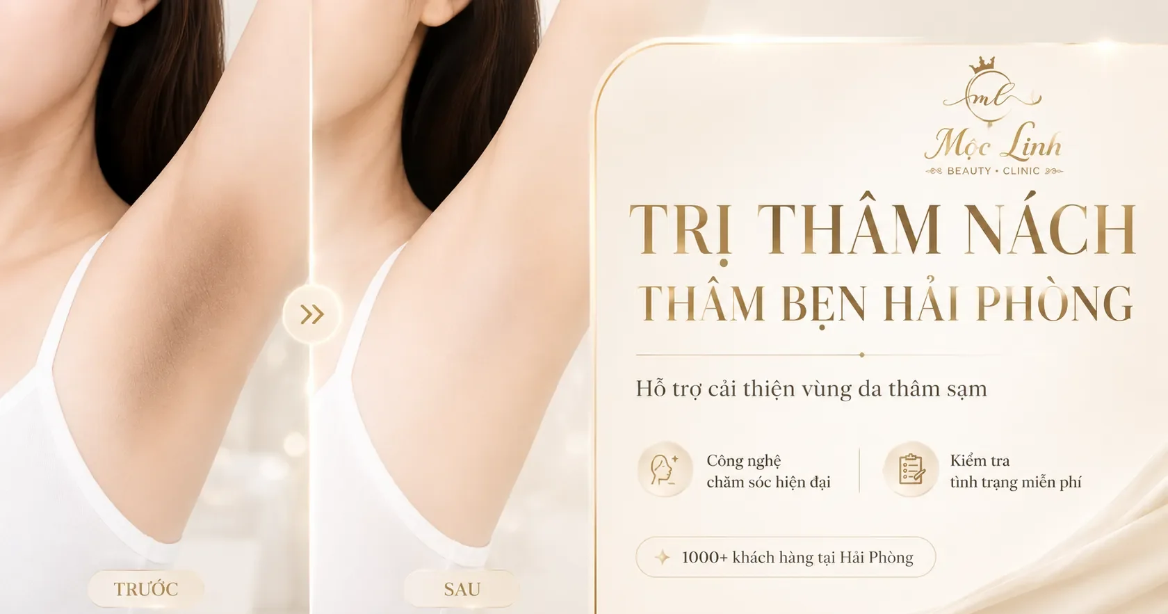 Trị Thâm Nách