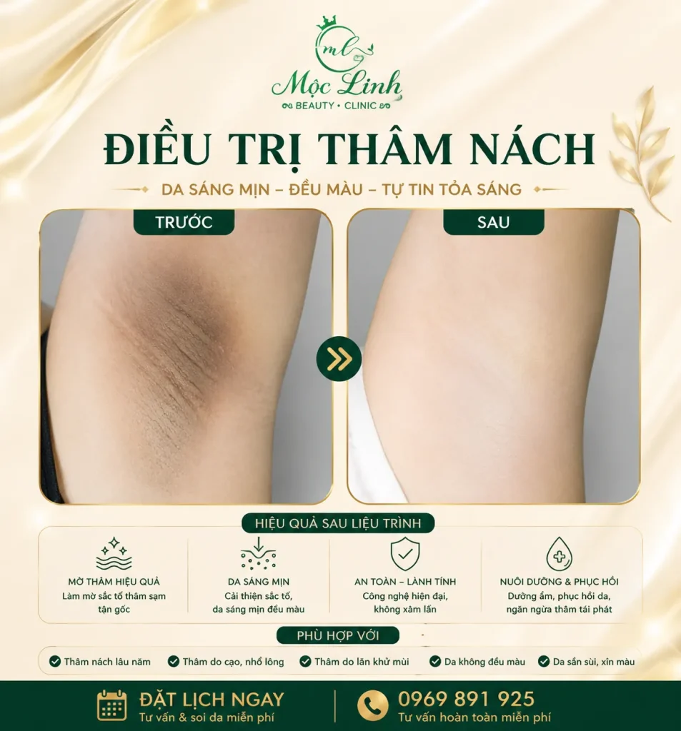 Trị thâm nách – bẹn Hải Phòng