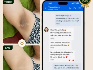 Trị thâm nách – bẹn Hải Phòng