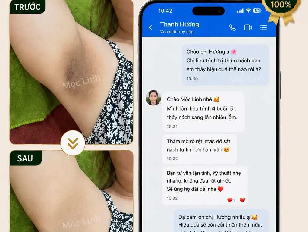 Trị thâm nách – bẹn Hải Phòng