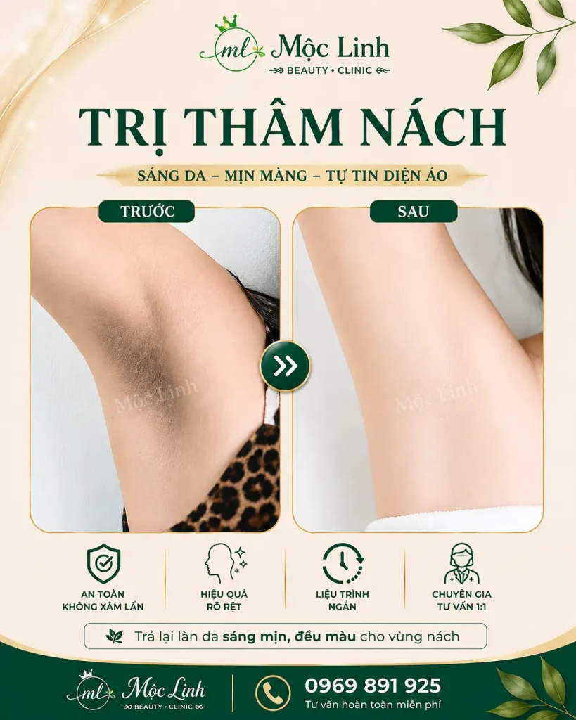Trị thâm nách – bẹn Hải Phòng