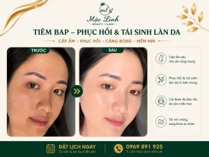 Tiêm BAP Uy Tín Hải Phòng