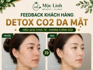 Detox CO2 Hải Phòng – Khi Làn Da Cần Được Làm Sạch Và Chăm Sóc Chuyên Sâu
