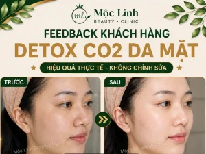 Detox CO2 Hải Phòng – Khi Làn Da Cần Được Làm Sạch Và Chăm Sóc Chuyên Sâu