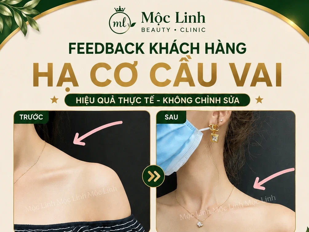 Tiêm Hạ Cơ Cầu Vai Hải Phòng