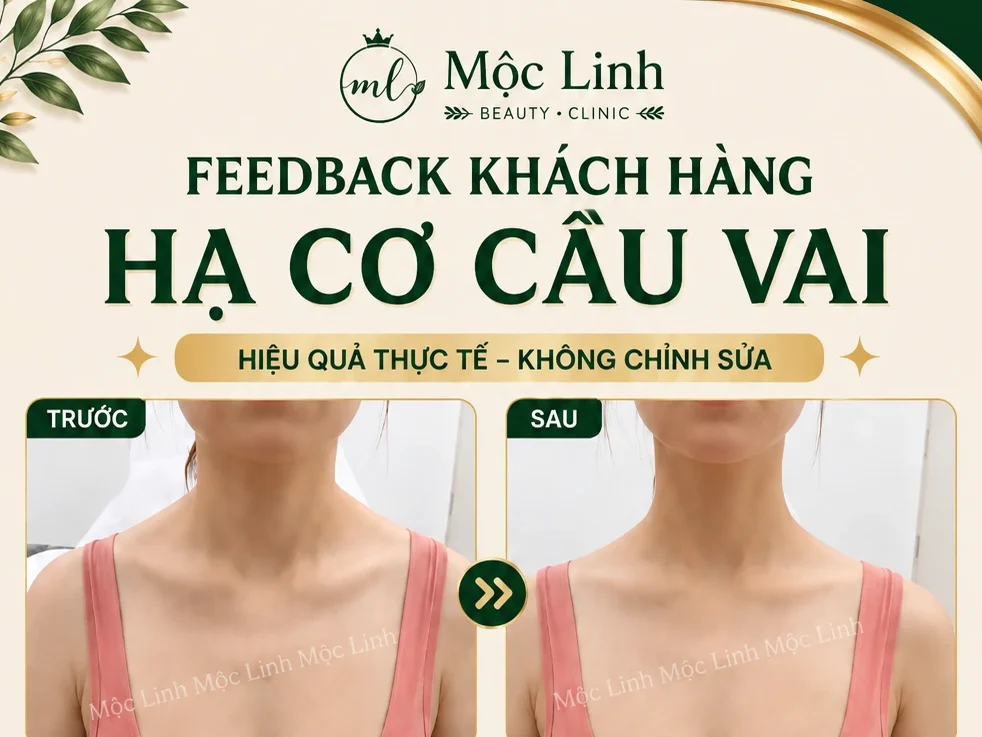 Tiêm Hạ Cơ Cầu Vai Hải Phòng