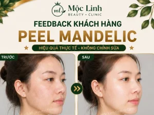 Peel Da Hải Phòng – Làn Da Cần Được Làm Mới Và Chăm Sóc Chuyên Sâu