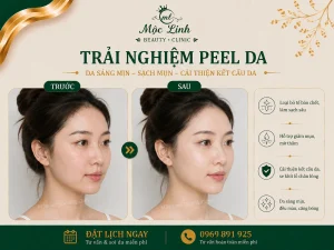 Peel Da Hải Phòng – Làn Da Cần Được Làm Mới Và Chăm Sóc Chuyên Sâu