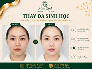 Thay Da Sinh Học Hải Phòng – Khi Làn Da Cần Một Chu Kỳ Tái Tạo Mới