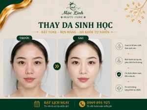 Thay Da Sinh Học Hải Phòng – Khi Làn Da Cần Một Chu Kỳ Tái Tạo Mới