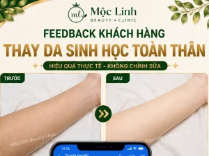 Thay Da Sinh Học Hải Phòng – Khi Làn Da Cần Một Chu Kỳ Tái Tạo Mới