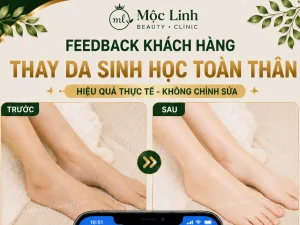 Thay Da Sinh Học Hải Phòng – Khi Làn Da Cần Một Chu Kỳ Tái Tạo Mới