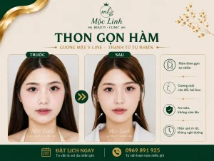 Tiêm Thon Gọn Hàm Hải Phòng