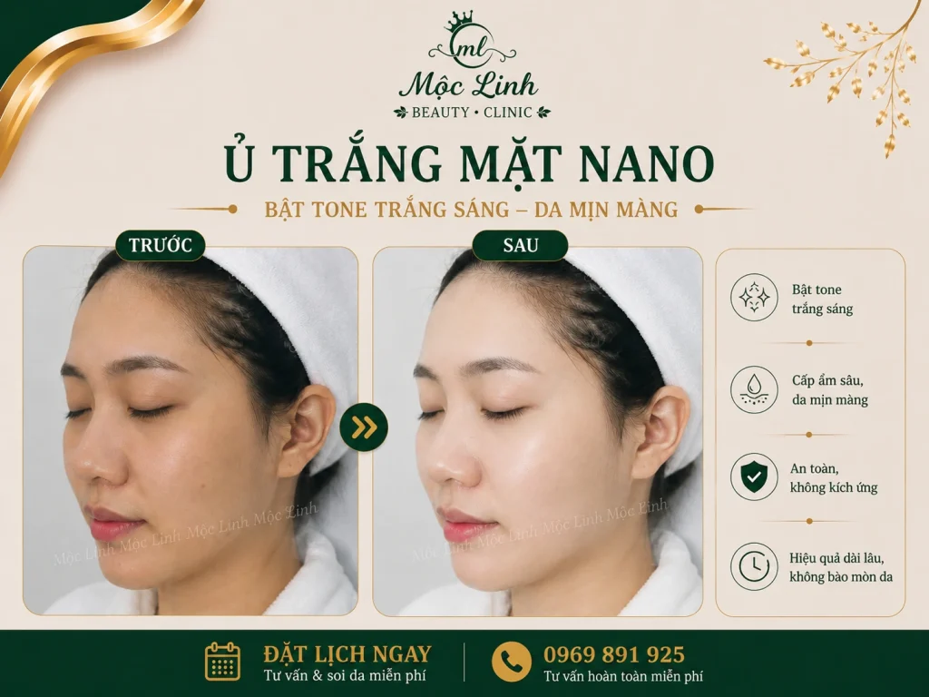 Ủ Trắng Mặt Nano Hải Phòng – Khi Làn Da Xỉn Màu Cần Được Chăm Sóc Đúng Cách