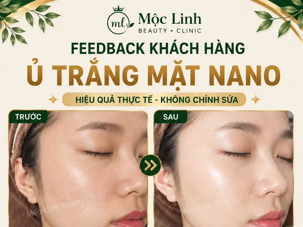 Ủ Trắng Mặt Nano Hải Phòng – Khi Làn Da Xỉn Màu Cần Được Chăm Sóc Đúng Cách