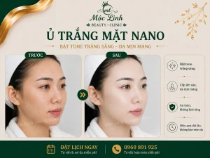 Ủ Trắng Mặt Nano Hải Phòng – Khi Làn Da Xỉn Màu Cần Được Chăm Sóc Đúng Cách