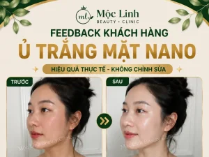 Ủ Trắng Mặt Nano Hải Phòng – Khi Làn Da Xỉn Màu Cần Được Chăm Sóc Đúng Cách