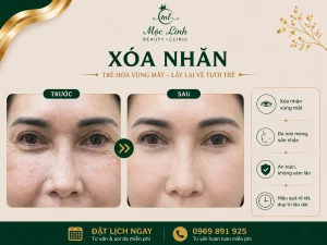 Xóa Nhăn Hải Phòng