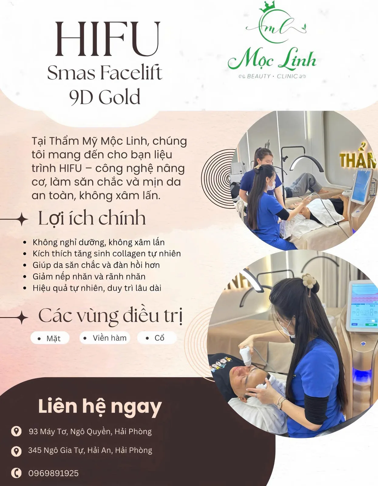 Nâng cơ Hifu trẻ hóa da mặt tại Thẩm Mỹ Mộc Linh Hải Phòng