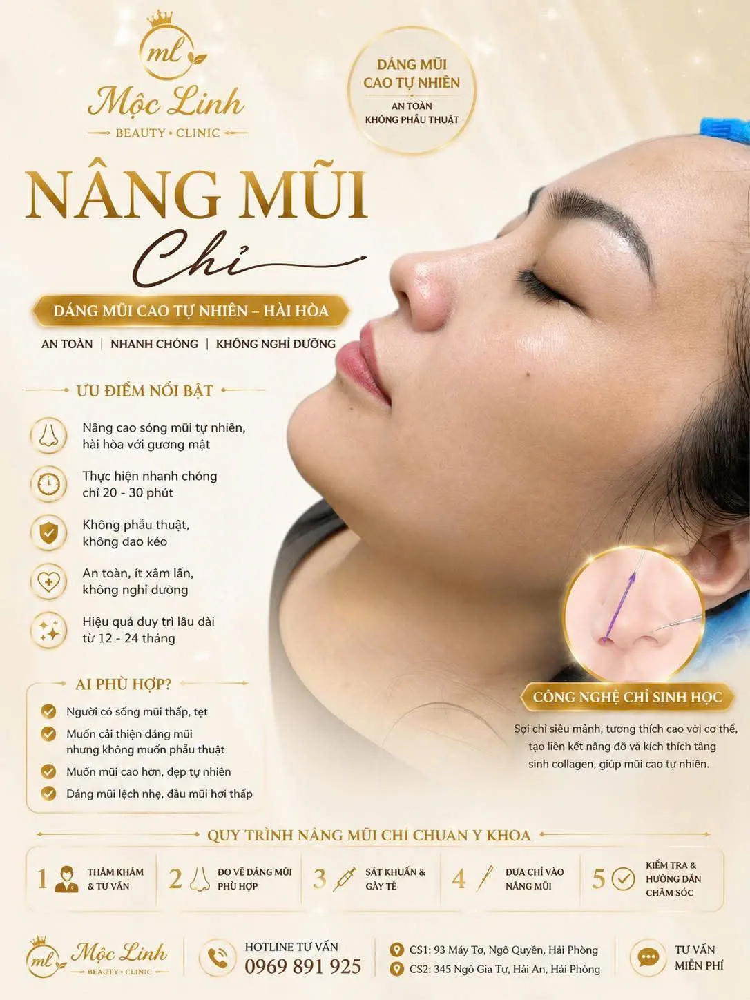 Nâng mũi thẩm mỹ tại Thẩm Mỹ Mộc Linh Hải Phòng
