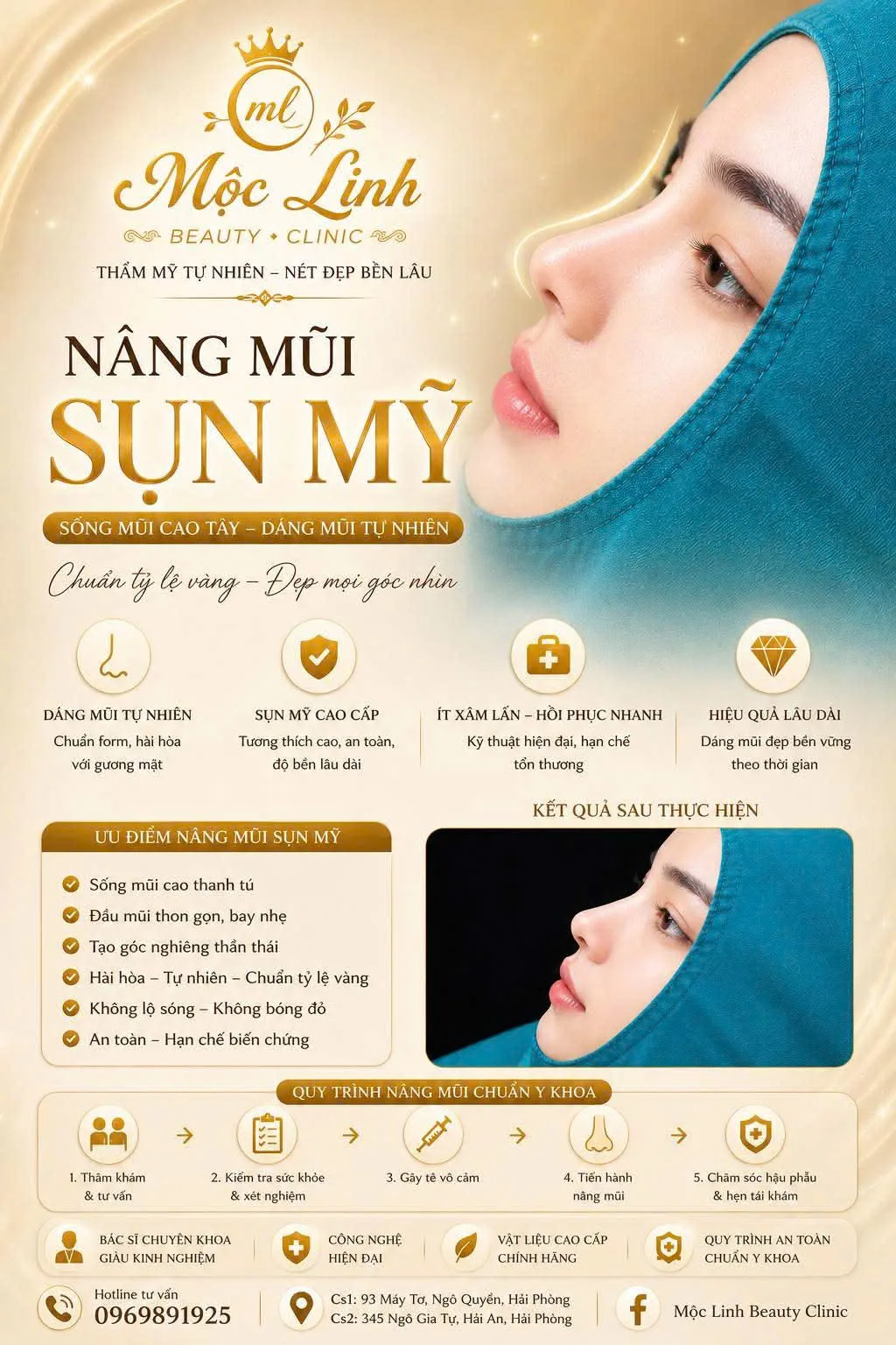 Các phương pháp nâng mũi đẹp tự nhiên tại Hải Phòng