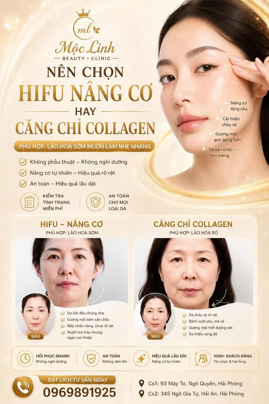 Công nghệ Hifu nâng cơ căng da tại Hải Phòng