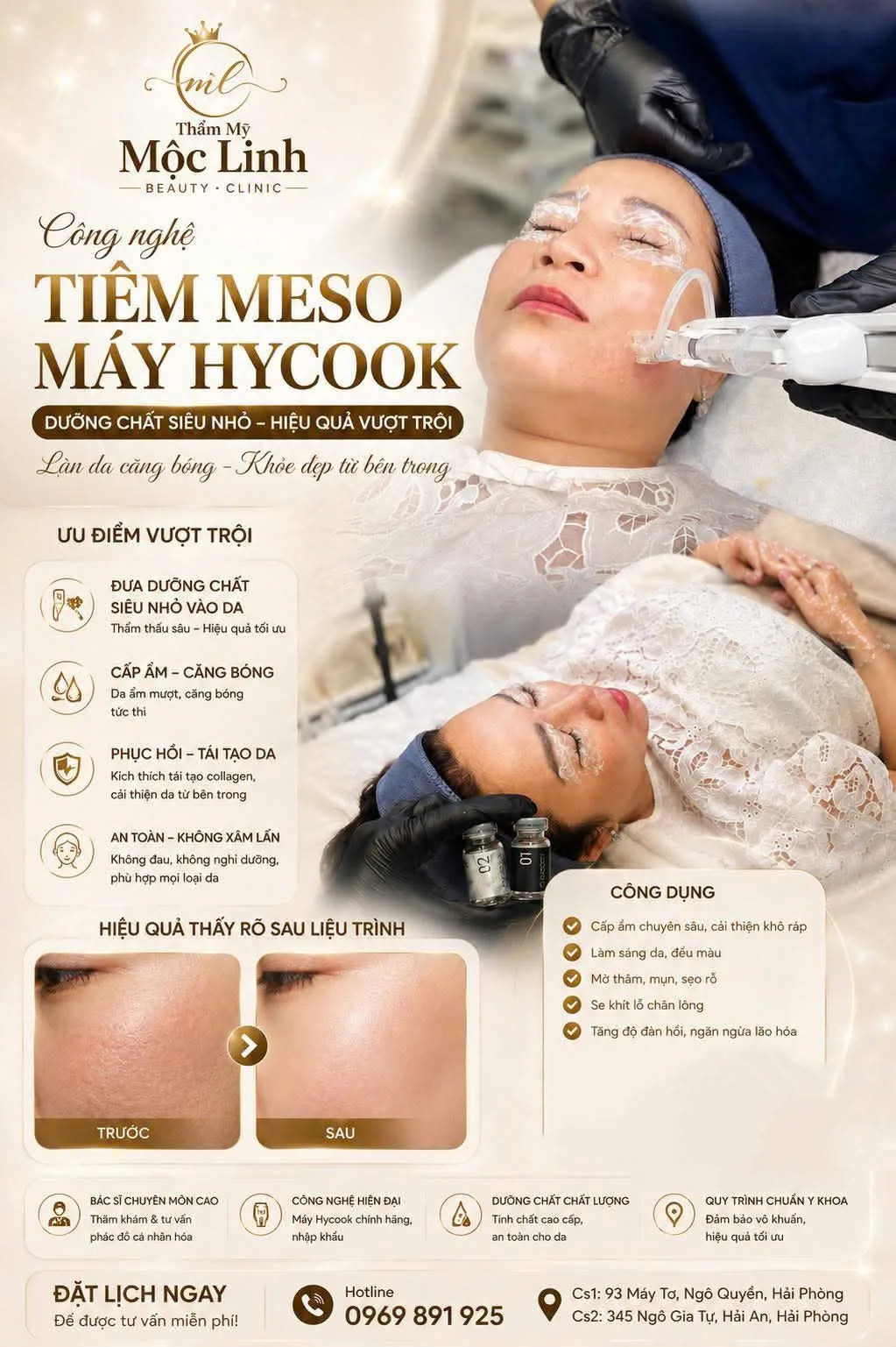 Tiêm meso trẻ hóa da tại Thẩm Mỹ Mộc Linh Hải Phòng