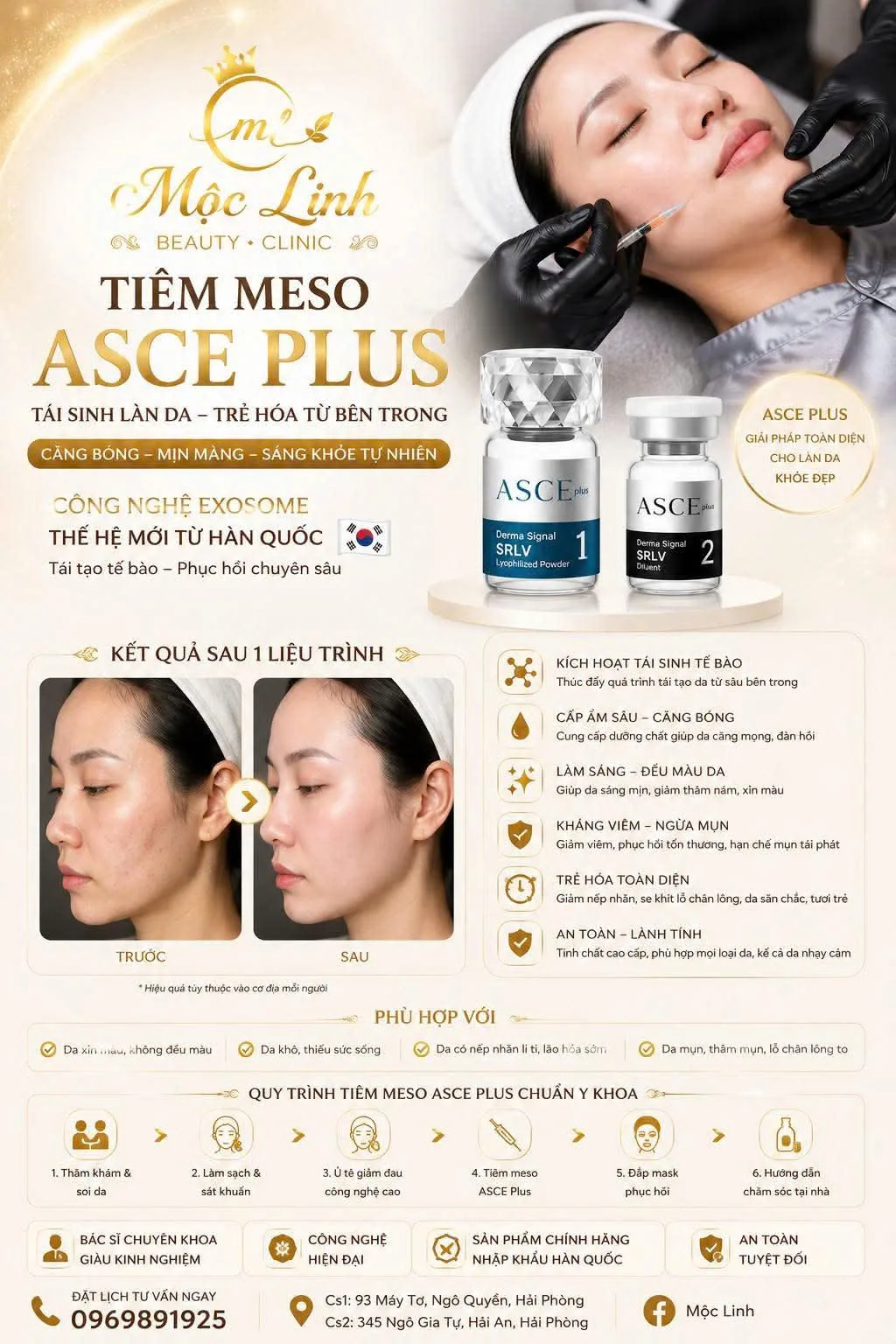 Liệu trình tiêm meso cấp ẩm cho da tại Hải Phòng