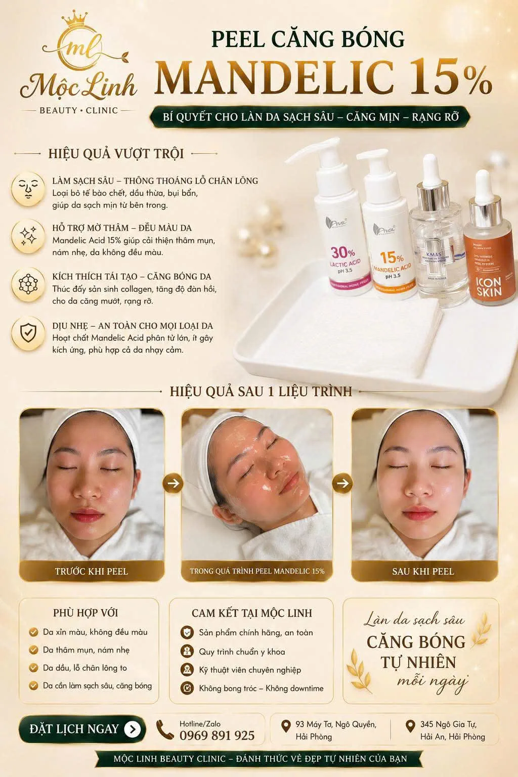 Lộ trình trị mụn theo từng loại da tại Hải Phòng