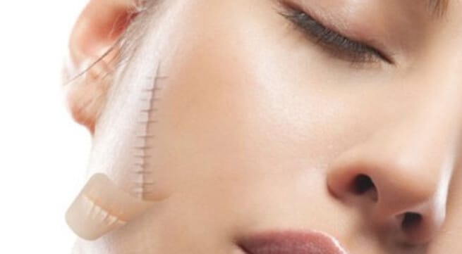 4 dưỡng chất quan trọng trong ngừa và điều trị sẹo lồi hiệu quả? - MD MEDICAL